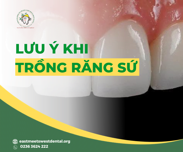 luu-y-khi-trong-rang-su