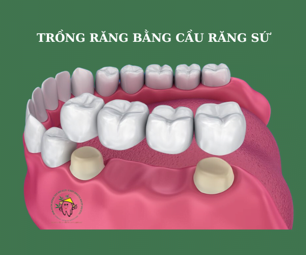 trong-rang-su-tai-da-nang