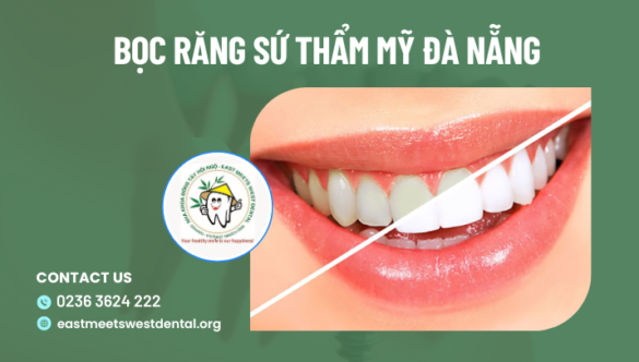 Bọc răng sứ thẩm mỹ Đà Nẵng ở đâu