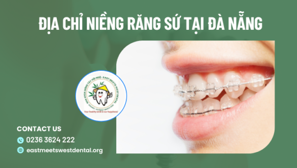 Địa chỉ niềng răng sứ tại Đà Nẵng