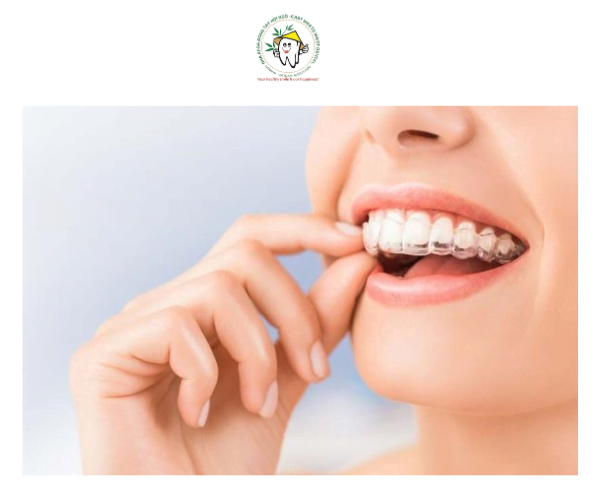 Invisalign sử dụng các khay niềng trong suốt
