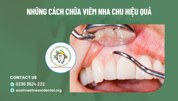 Những cách chữa viêm nha chu hiệu quả nhất