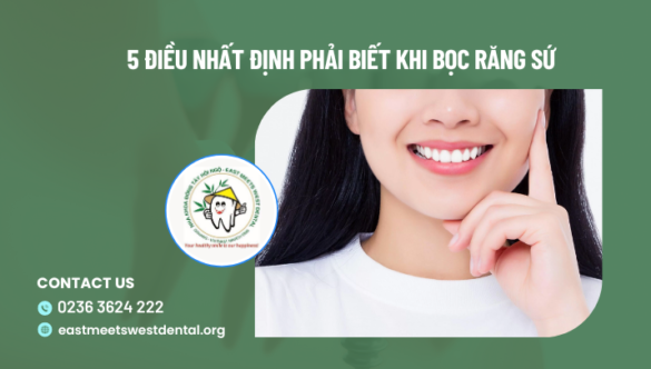 5 điều nhất định phải biết khi bọc răng sứ