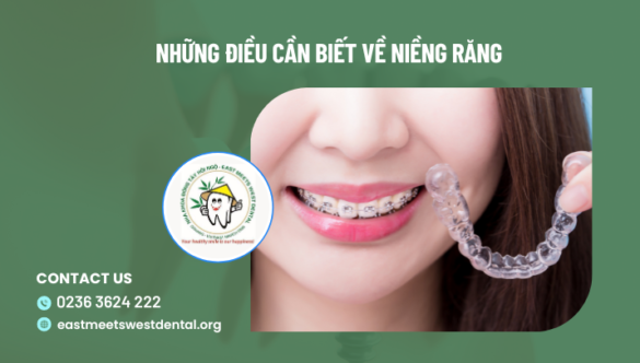 “Bỏ túi” những điều cần biết khi niềng răng