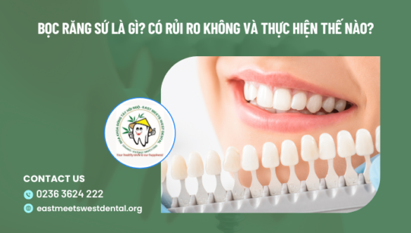 Bọc răng sứ tại Đà Nẵng? Có rủi ro không và thực hiện thế nào?