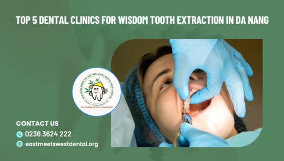 Top 5 Dental Clinics for Wisdom Tooth Extraction in Da Nang