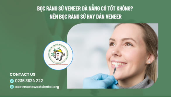 Bọc răng sứ veneer Đà Nẵng có tốt không? Nên bọc răng sứ hay dán Veneer