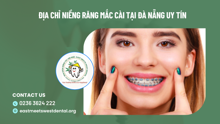 Địa chỉ niềng răng mắc cài tại Đà Nẵng uy tín