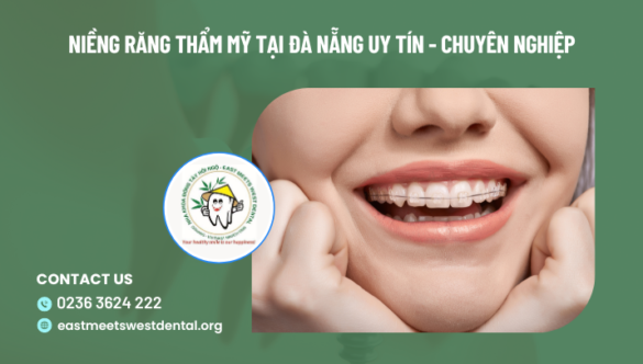 Niềng răng thẩm mỹ tại Đà Nẵng uy tín – chuyên nghiệp