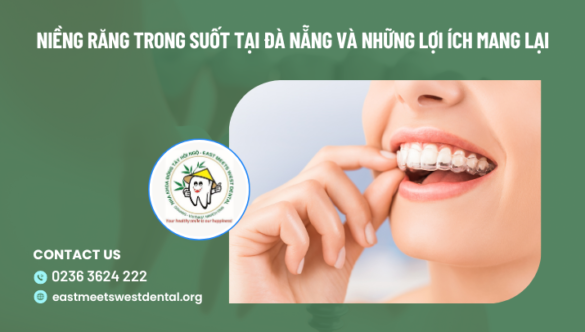 Niềng răng trong suốt tại Đà Nẵng và những lợi ích mang lại