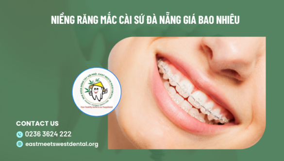 Niềng răng mắc cài sứ Đà Nẵng giá bao nhiêu?