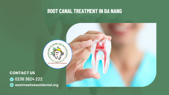 Root Canal Treatment in Da Nang