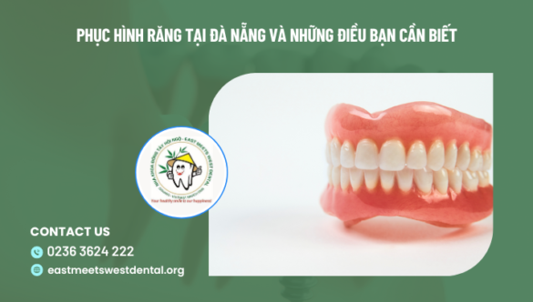 Phục hình răng tại Đà Nẵng và những điều bạn cần biết