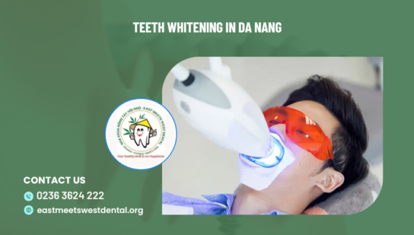 Teeth whitening in Da Nang