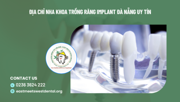 Nha khoa trồng răng implant Đà Nẵng uy tín