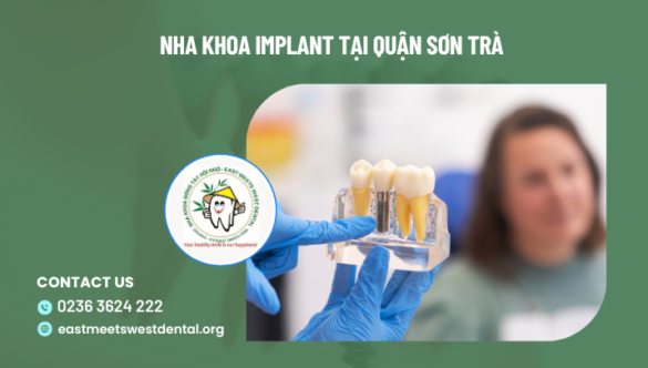 Nha khoa implant tại quận Sơn Trà