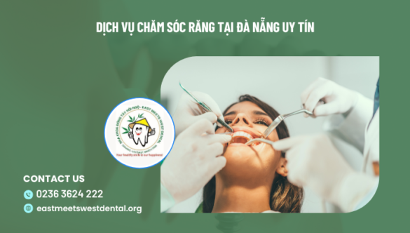 Dịch vụ chăm sóc răng tại Đà Nẵng uy tín