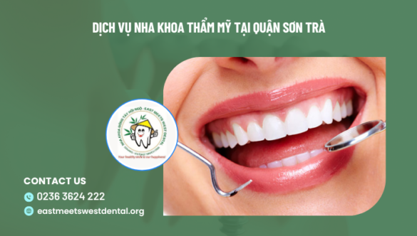 Dịch vụ nha khoa thẩm mỹ tại quận Sơn Trà
