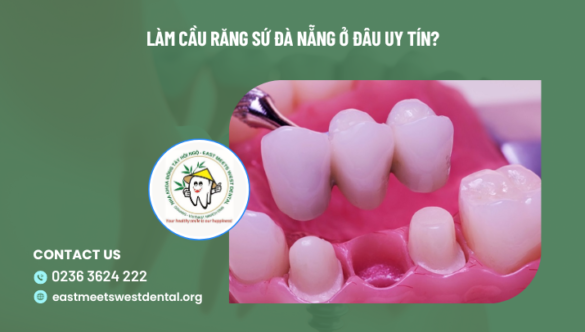 Làm cầu răng sứ Đà Nẵng ở đâu uy tín?