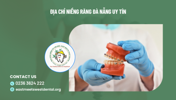 Địa chỉ niềng răng Đà Nẵng uy tín