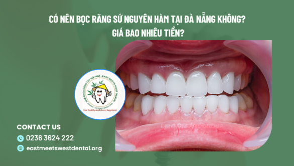 Có nên bọc răng sứ nguyên hàm tại Đà Nẵng không? Giá bao nhiêu tiền?