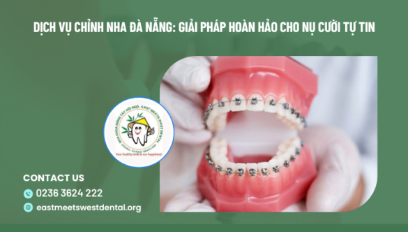 Dịch vụ chỉnh nha Đà Nẵng: Giải pháp hoàn hảo cho nụ cười tự tin