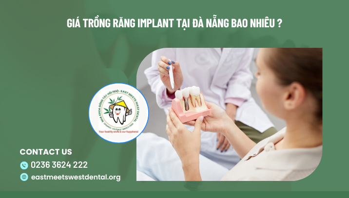 Chi phí trồng răng implant Đà Nẵng
