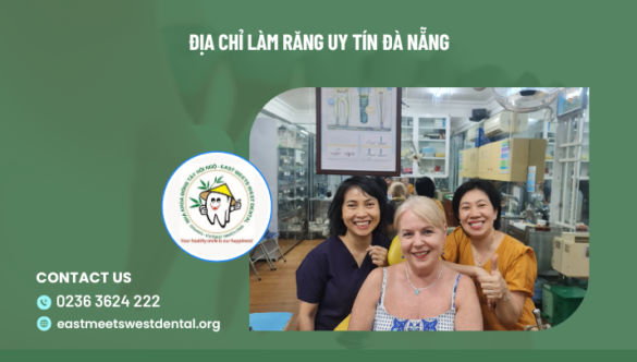 Mách bạn địa chỉ làm răng uy tín Đà Nẵng