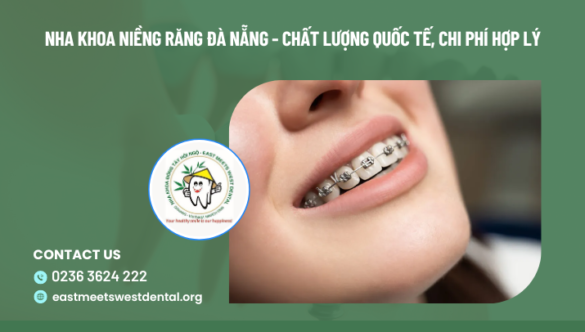 Nha Khoa Niềng Răng Đà Nẵng – Chất Lượng Quốc Tế, Chi Phí Hợp Lý