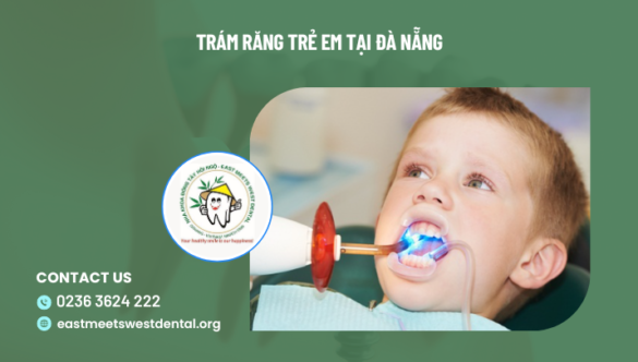 Trám răng trẻ em tại Đà Nẵng