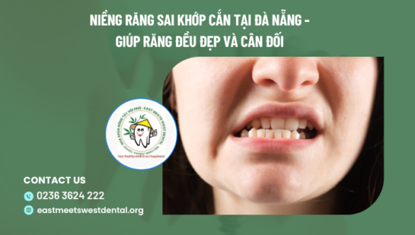 Niềng răng sai khớp cắn tại Đà Nẵng – giúp răng đều đẹp và cân đối