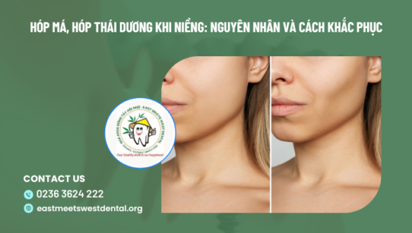 Hóp má, hóp thái dương khi niềng: Nguyên nhân và cách khắc phục