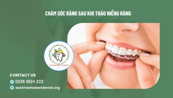 Chăm sóc răng sau khi tháo niềng răng