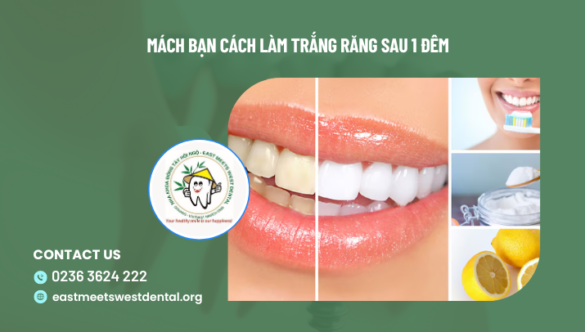 Mách bạn 8 cách làm trắng răng sau 1 đêm