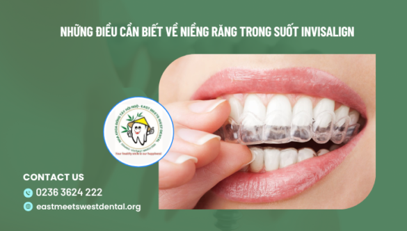 Những điều cần biết về Niềng răng trong suốt Invisalign