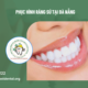 Phục Hình Răng Sứ Tại Đà Nẵng