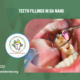 Teeth fillings in Da Nang