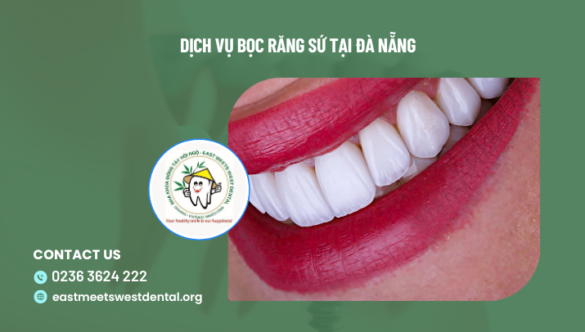 Dịch vụ bọc răng sứ tại Đà Nẵng