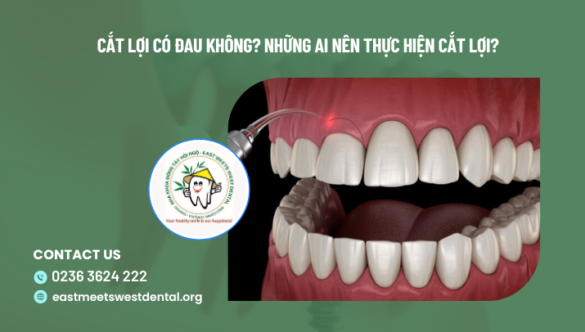 Cắt lợi có đau không? Những ai nên thực hiện cắt lợi?