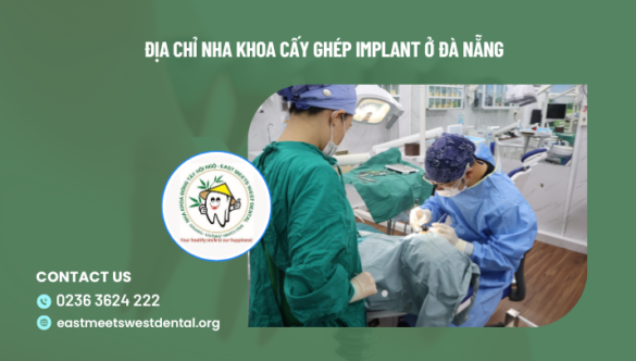 Địa chỉ nha khoa cấy ghép implant ở Đà Nẵng