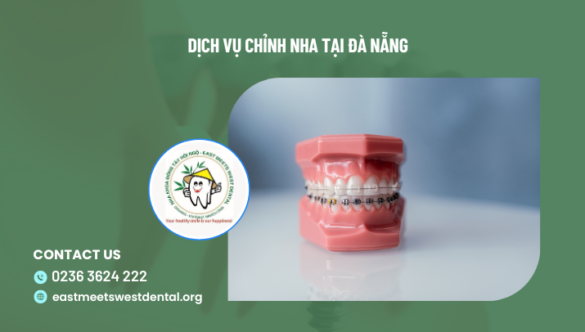 Dịch vụ chỉnh nha tại Đà Nẵng