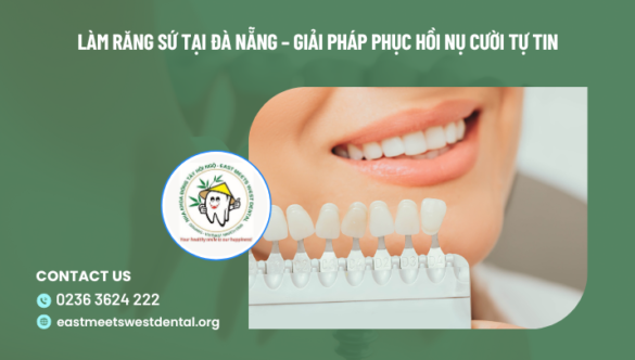 Làm răng sứ tại Đà Nẵng