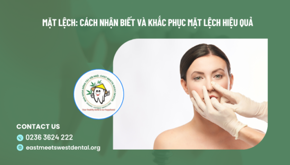 Mặt lệch: Cách nhận biết và khắc phục mặt lệch hiệu quả