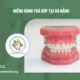 Niềng Răng Trả Góp Tại Đà Nẵng