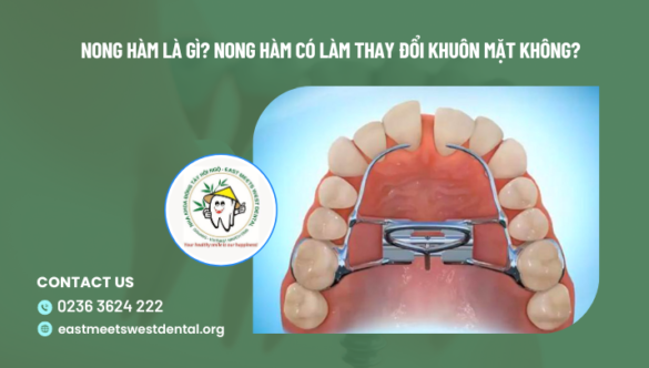 Nong hàm là gì và có tác dụng ra sao?