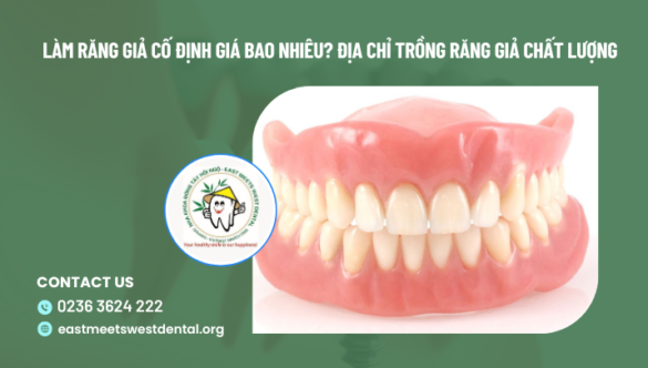 Làm răng giả cố định giá bao nhiêu? Địa chỉ trồng răng giả chất lượng