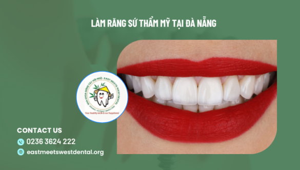 Làm răng sứ thẩm mỹ tại Đà Nẵng