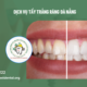 Dịch vụ tẩy trắng răng Đà Nẵng